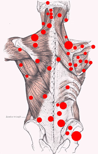 Trigger Points